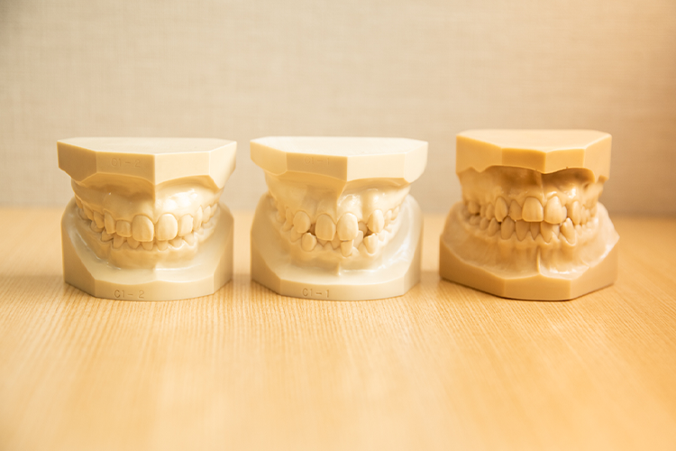 歯並びの症状について