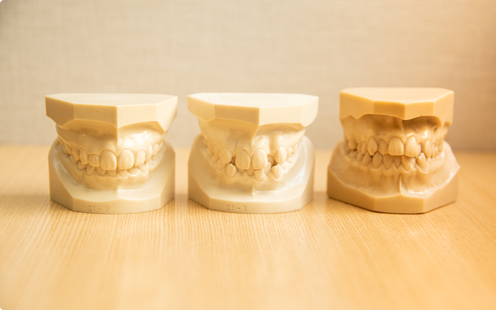 歯並びの症状について